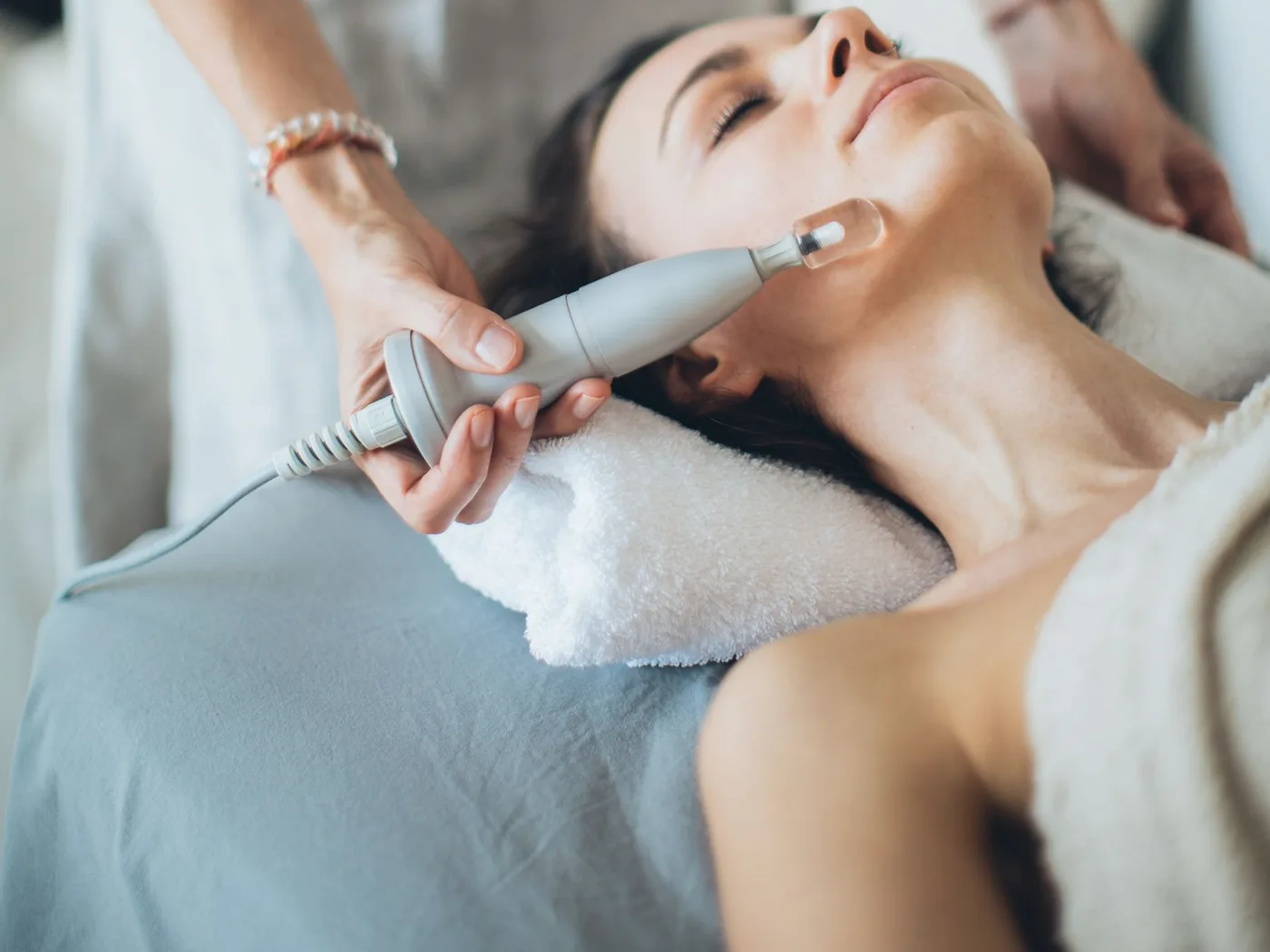 Tratamiento de microneedling con vitaminas en Remei