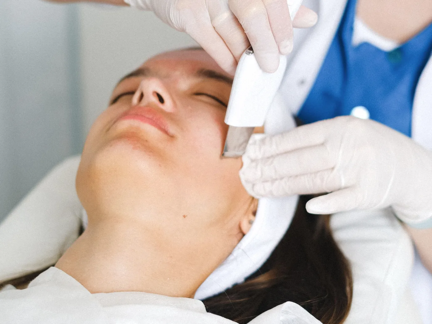 Aplicación de peeling de mandélico en Remei